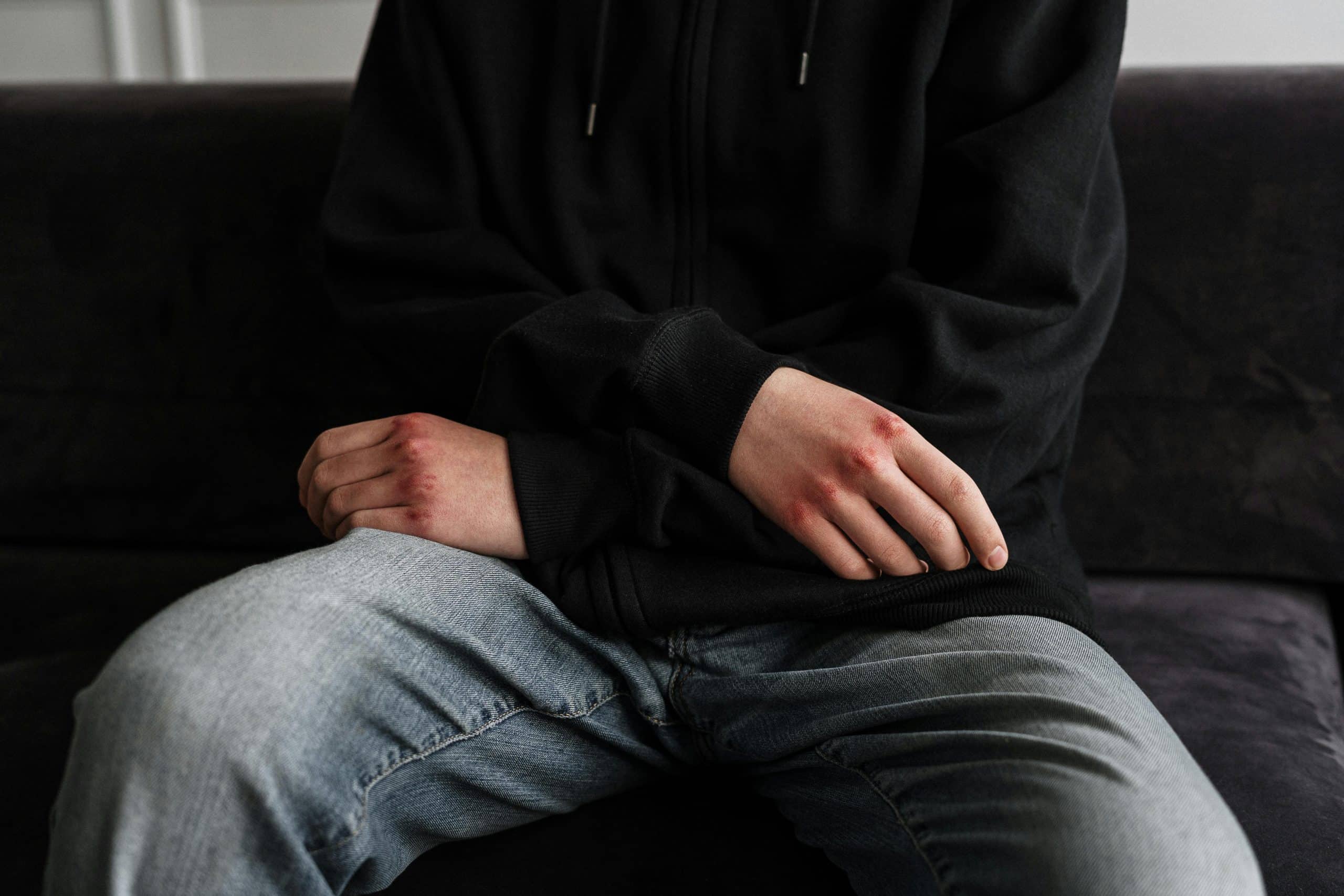 Comportamentos Autolesivos em Adolescentes