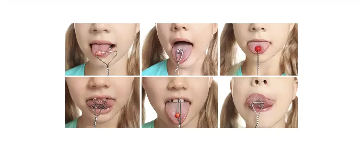 Terapia Miofuncional Orofacial